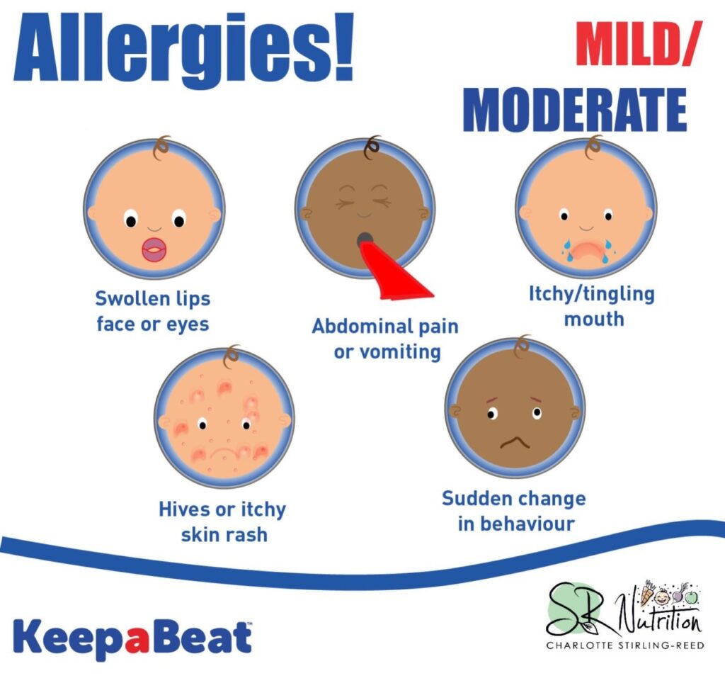 Food Allergy Symptoms: Weaning